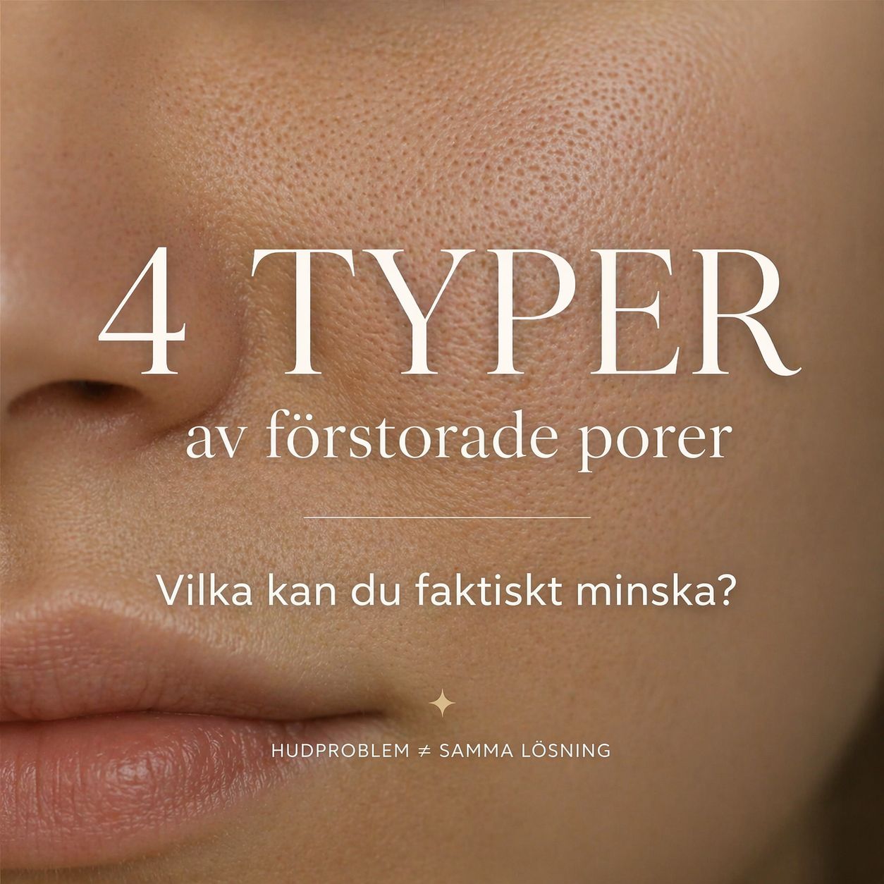 Olika typer av porer – hur du minskar stora porer och får jämnare hud