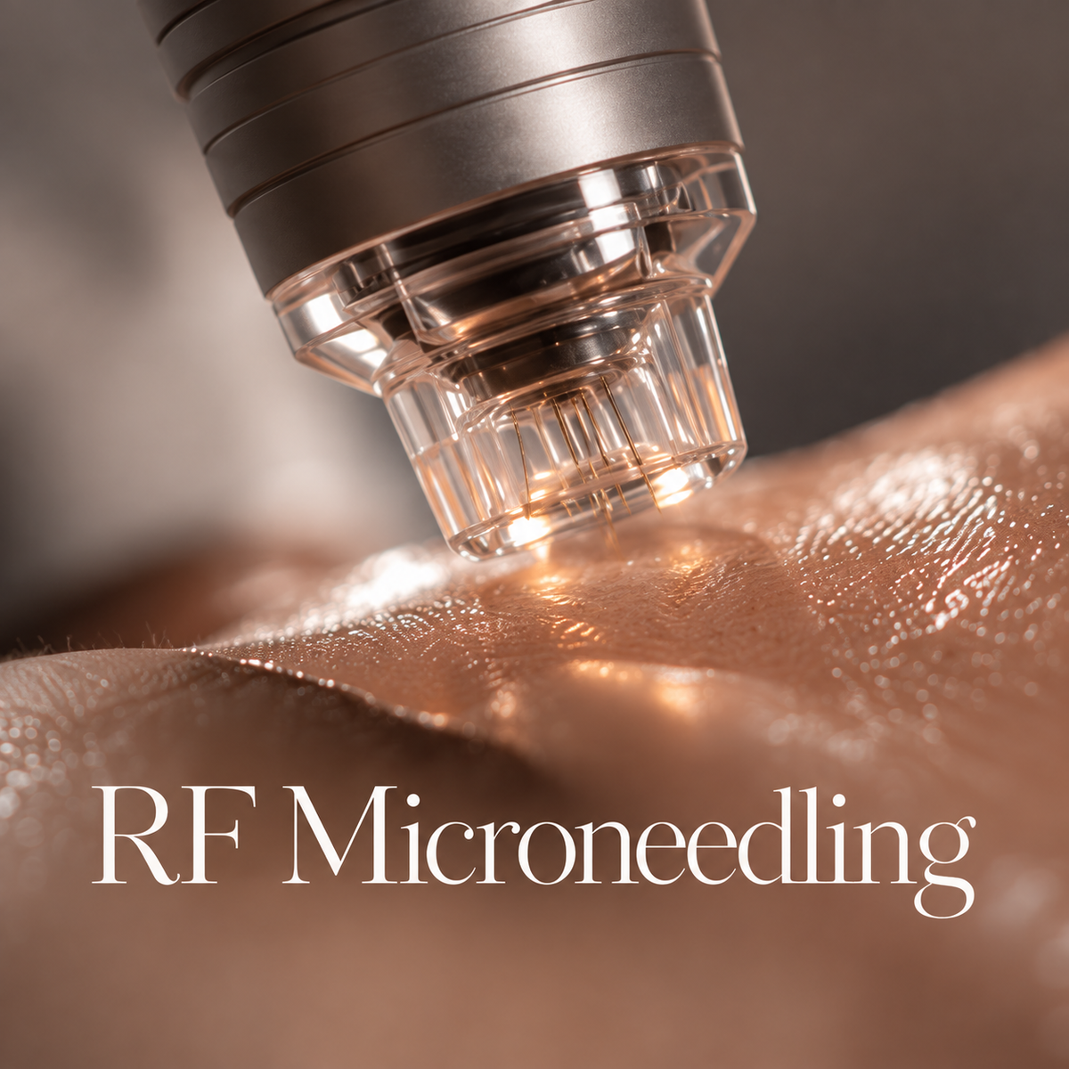 Kurs i Radiofrekvens Microneedling.