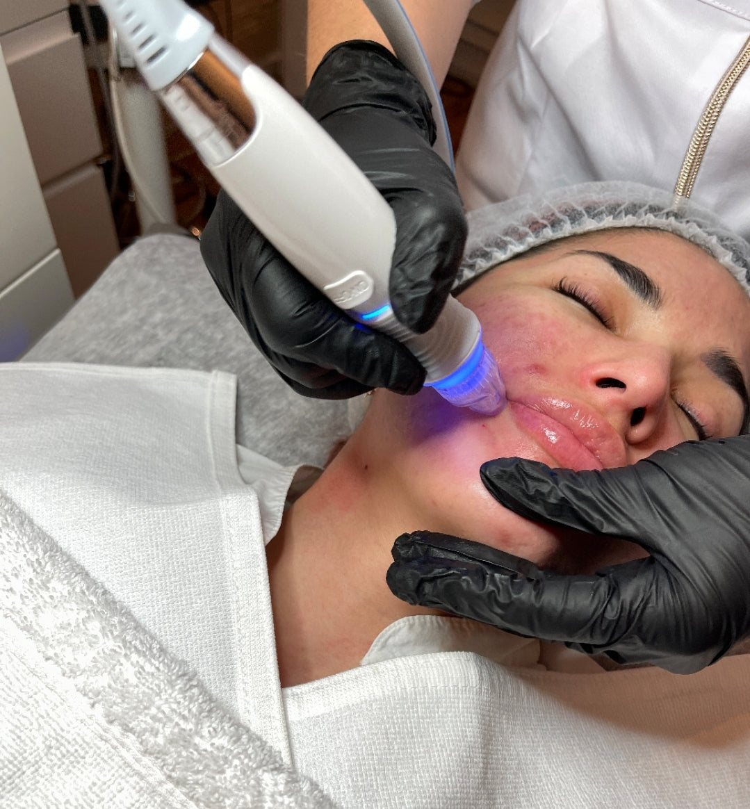 Hydrafacial behandling