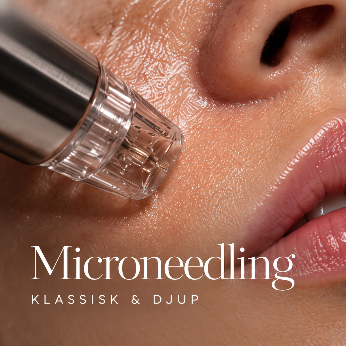 Microneedling utbildning – klassisk och djup teknik inkl. startkit