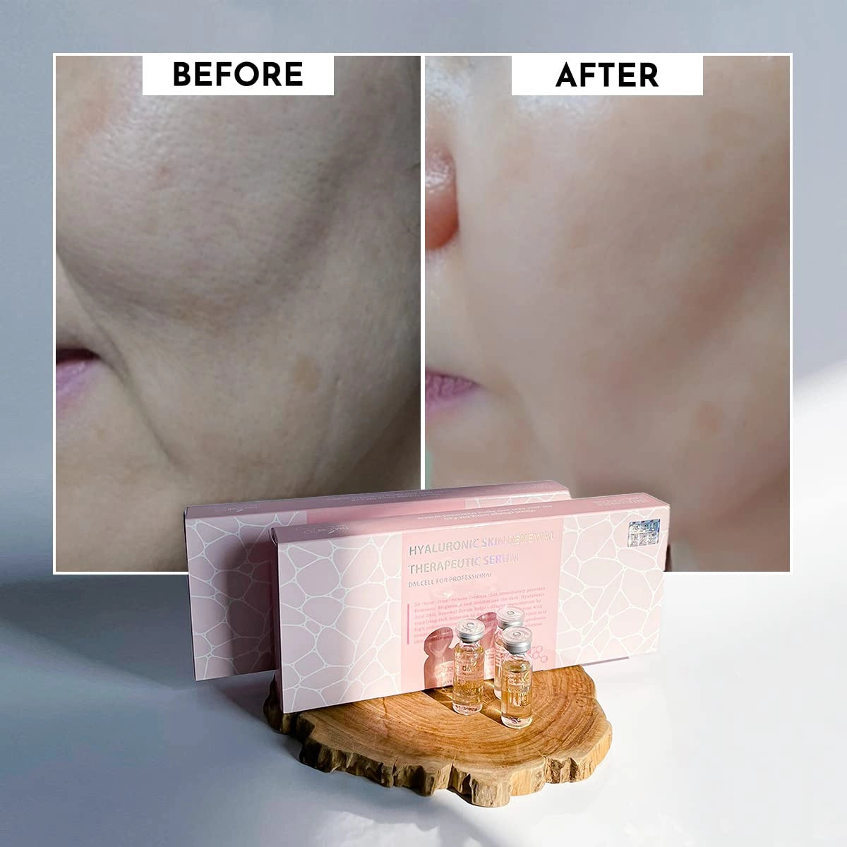 DM.Cell Hyaluronic Skin Renewal Serum före och efter med återfuktad, jämnare och mer fyllig hud