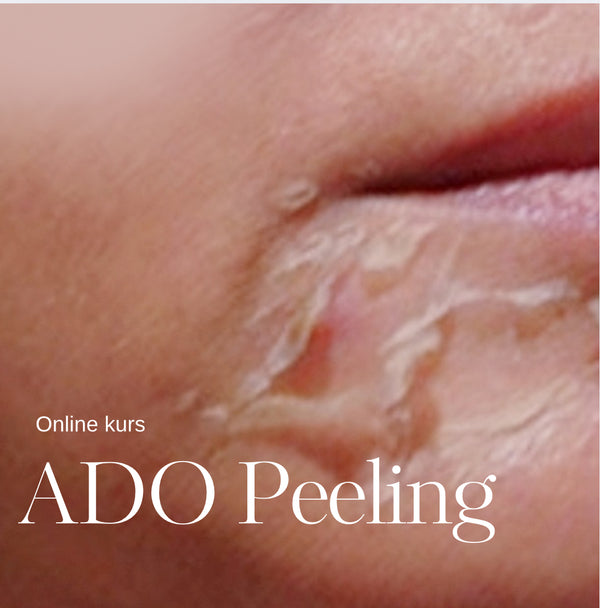 ONLINE KURS i ADO Kemisk Peeling (Yellow Rosé)