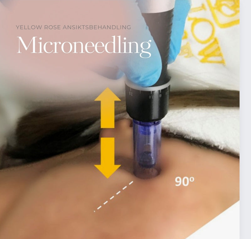 Microneedling behandling
